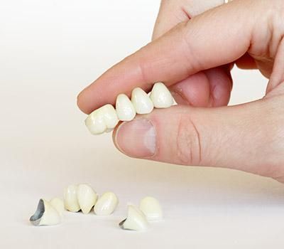 Implant Crown in Redwood City & Pleasanton CA Implant Crown in Redwood City & Pleasanton CA