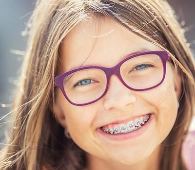 Braces in Redwood City & Pleasanton CA Braces in Redwood City & Pleasanton CA